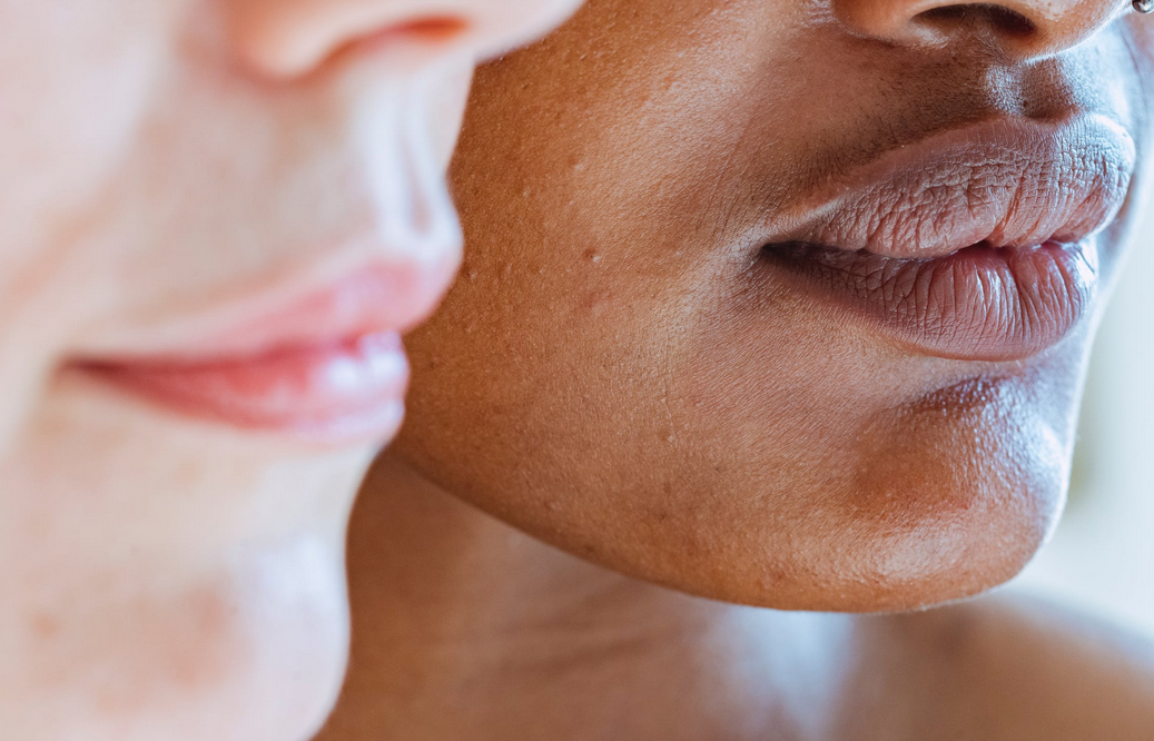 skin tags